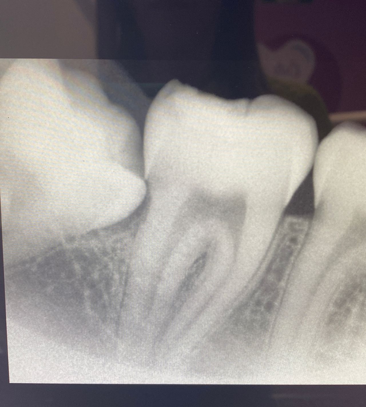 Georgina Zurita Rdz-7