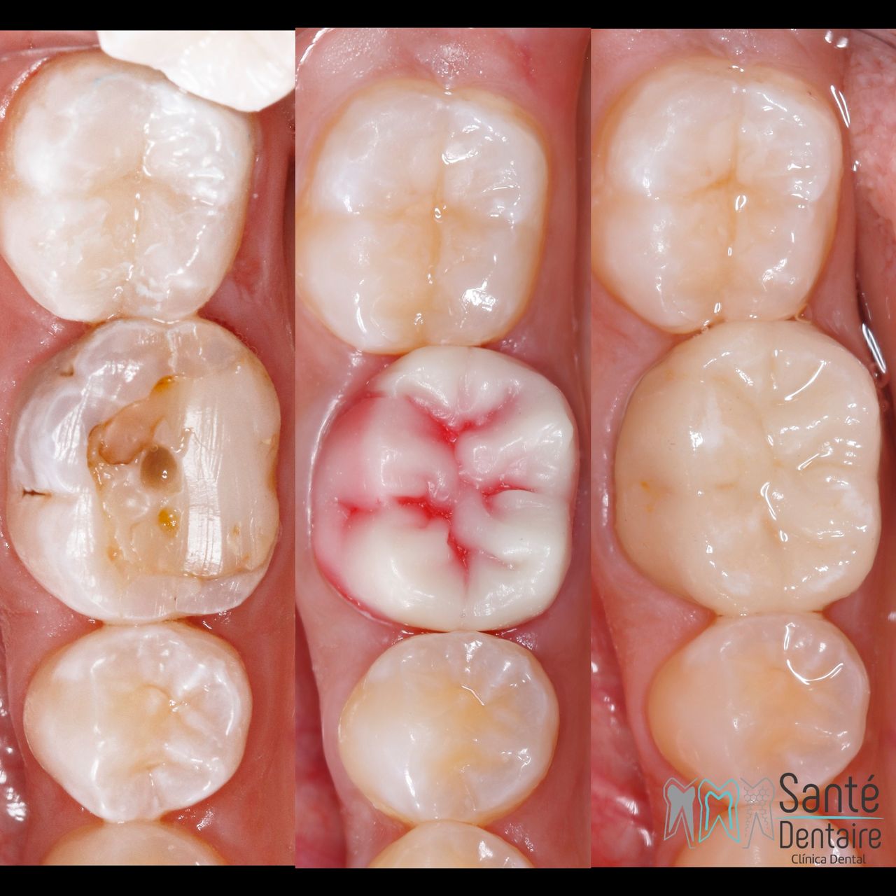 Daniel Oñate Robledo-30