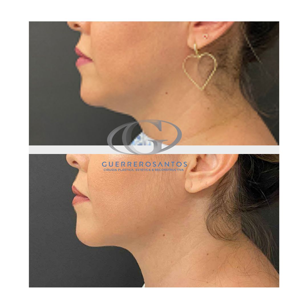 Fernando Guerrerosantos-1