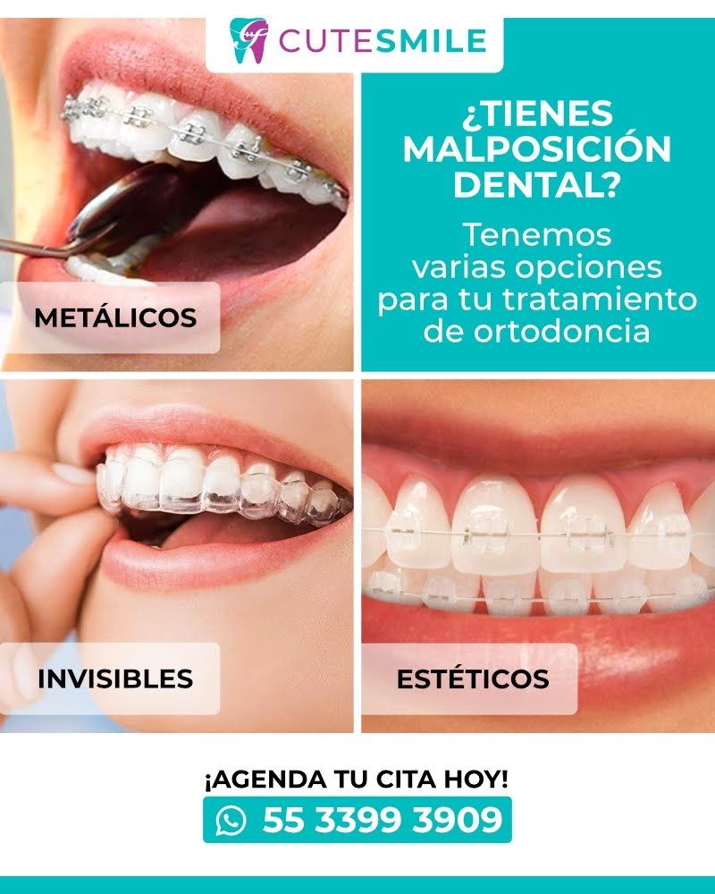 Georgina Zurita Rdz-1