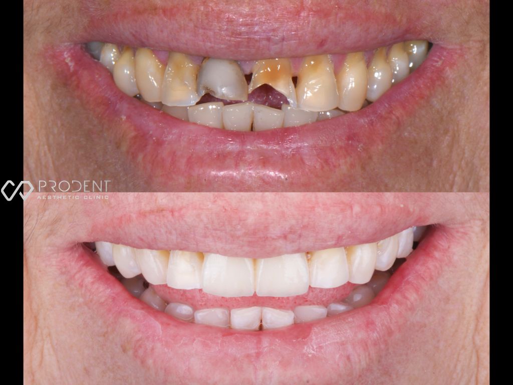 Ulises Pérez Murillo-83