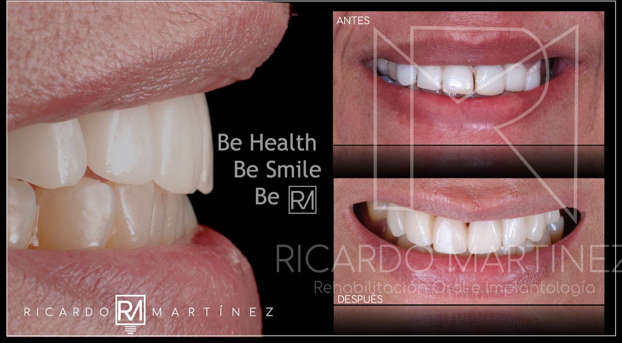 J. Ricardo Martínez-2