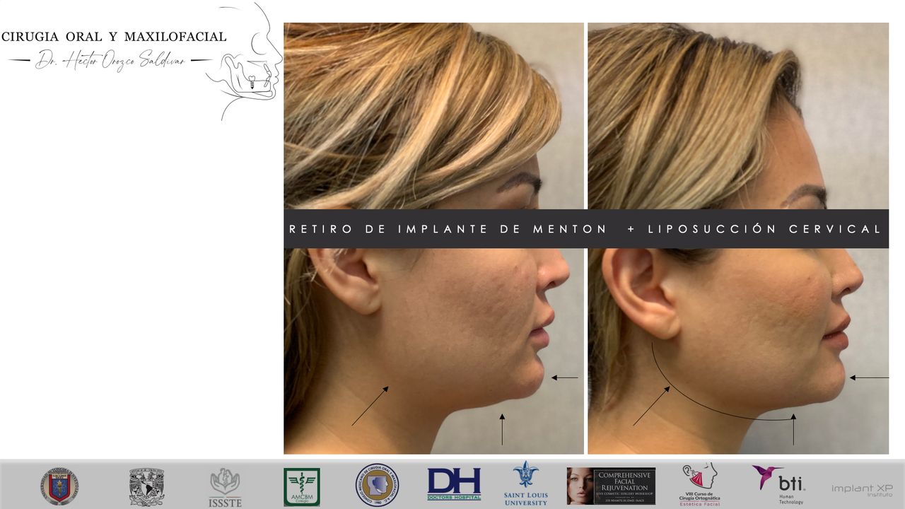 Héctor Adolfo Orozco Saldívar-30