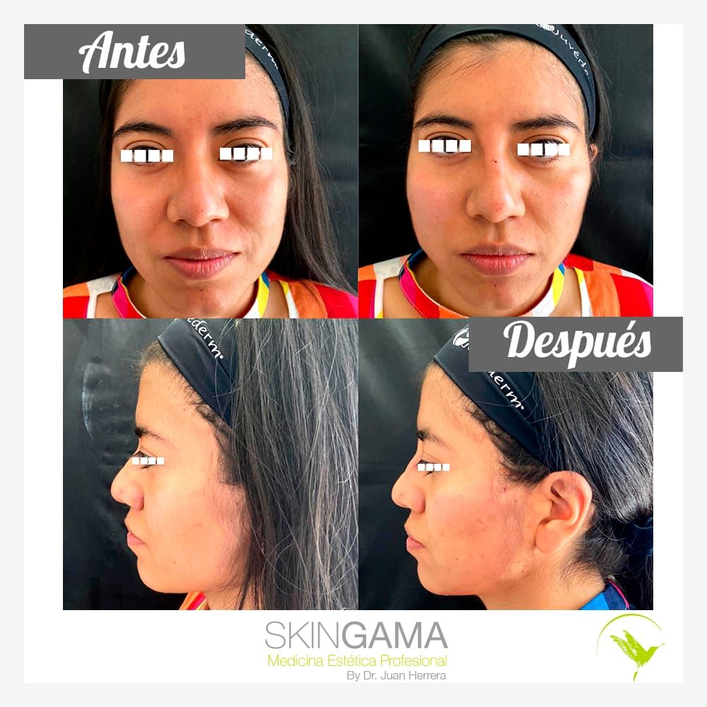 Juan Herrera Hernández-35