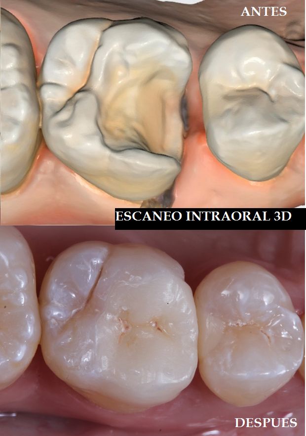 Ireri Rojas Bermúdez-14