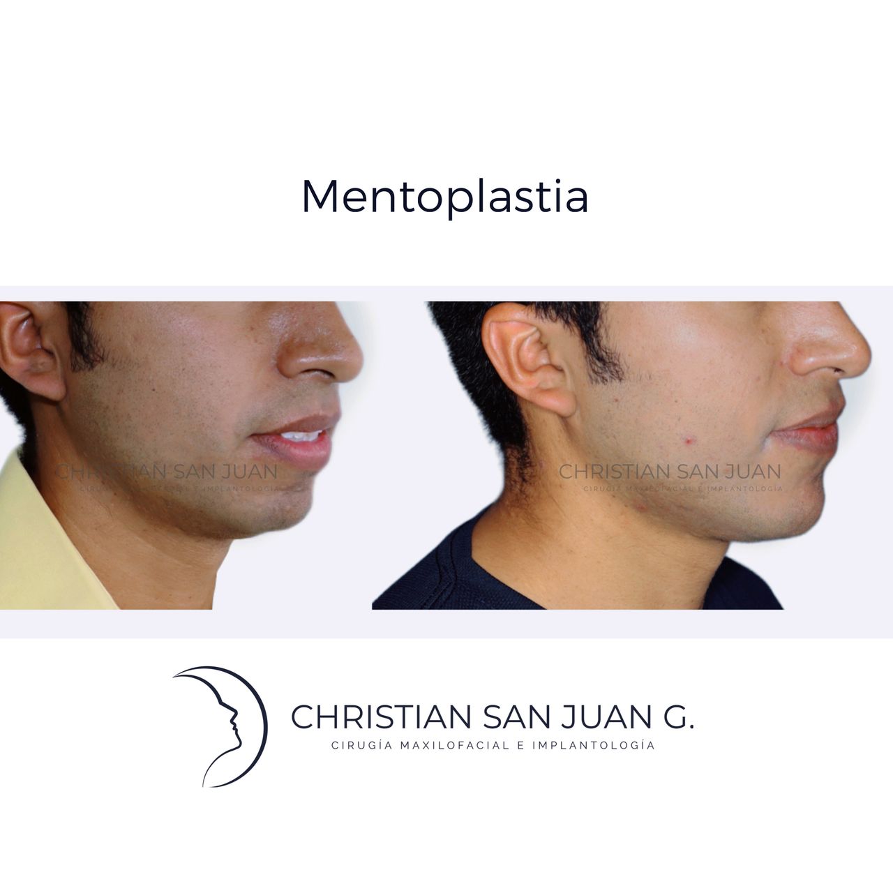 Christian San Juan González-7