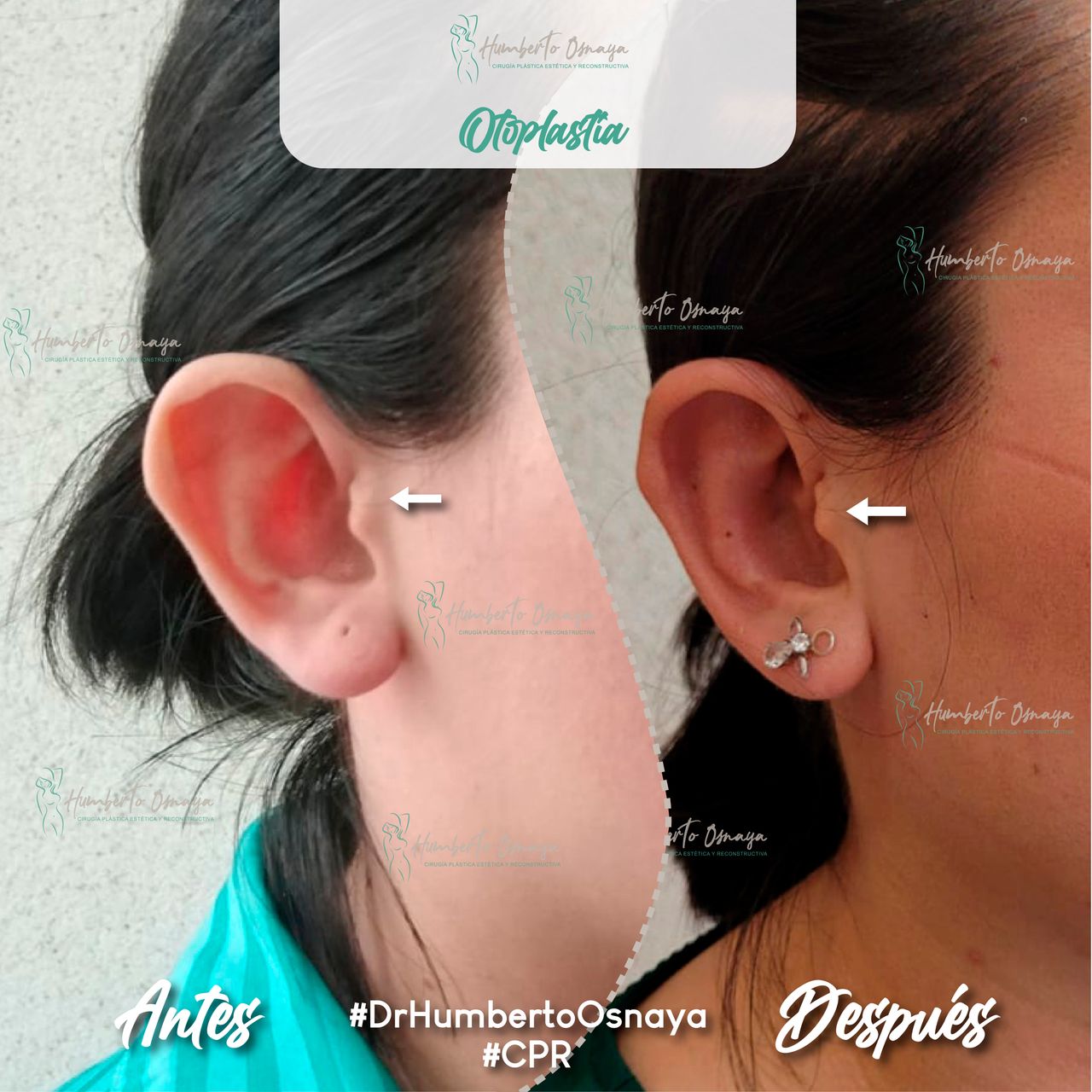 Humberto Osnaya Moreno-21