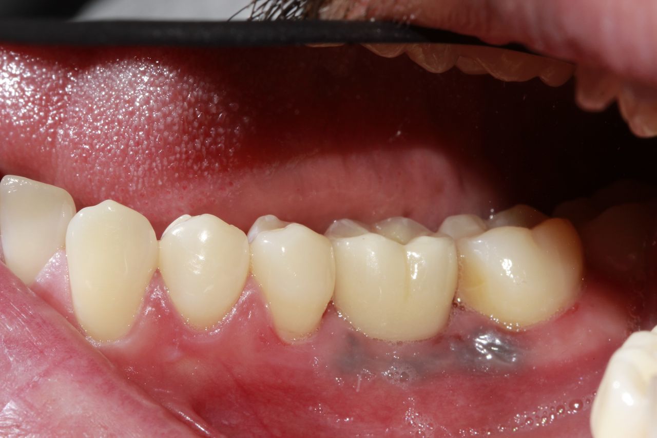 Mariel Itzayani Torres López-38