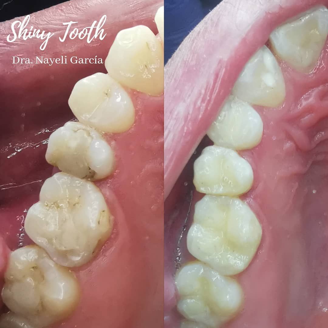 Nayeli Garcia Morales-44