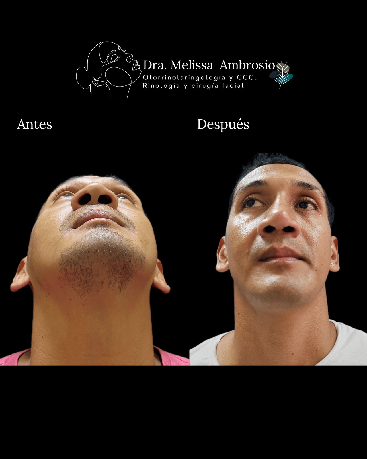 Melissa Guadalupe Ambrosio Mendoza-14