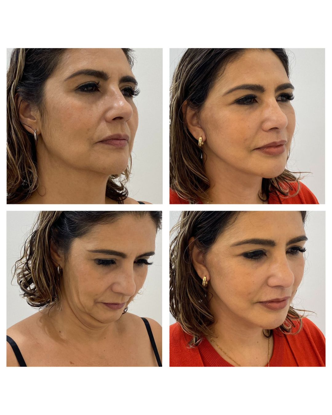 Nashielli Torres Espinosa Chiu-31