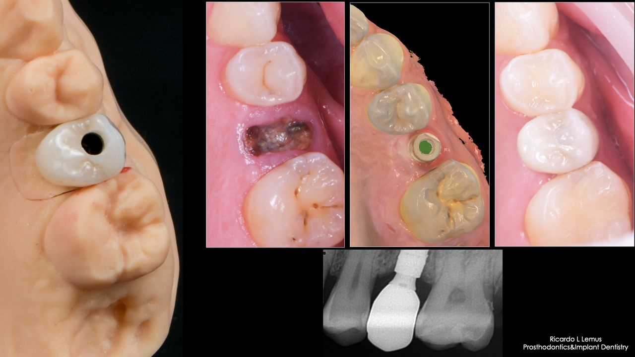 Ricardo López Lemus-125