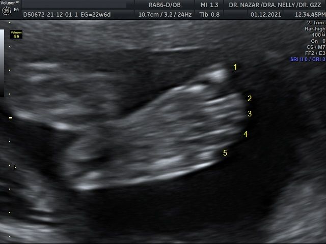 Miguel Angel González Nazar-13