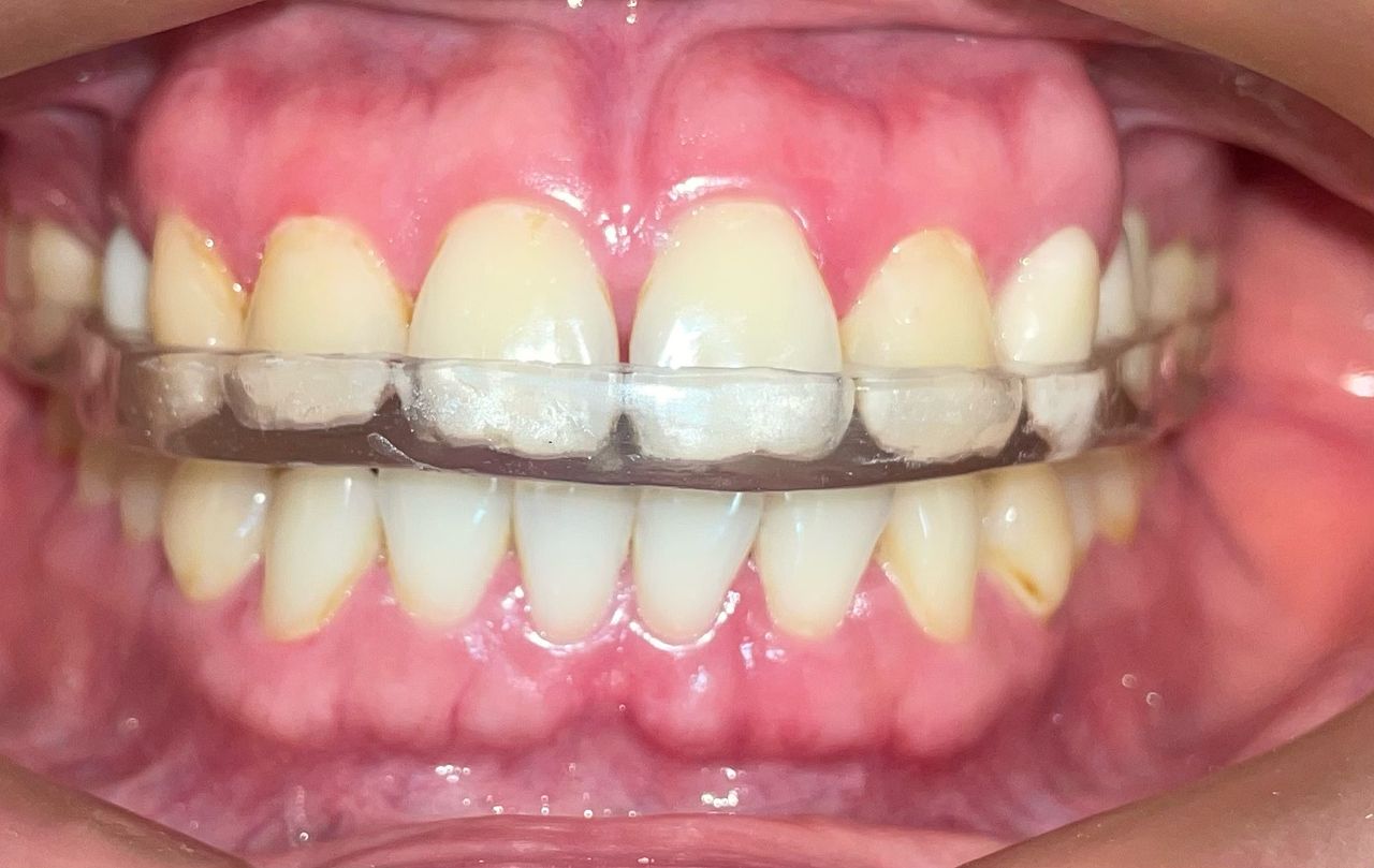 Luis Ernesto Calva Valdez-14