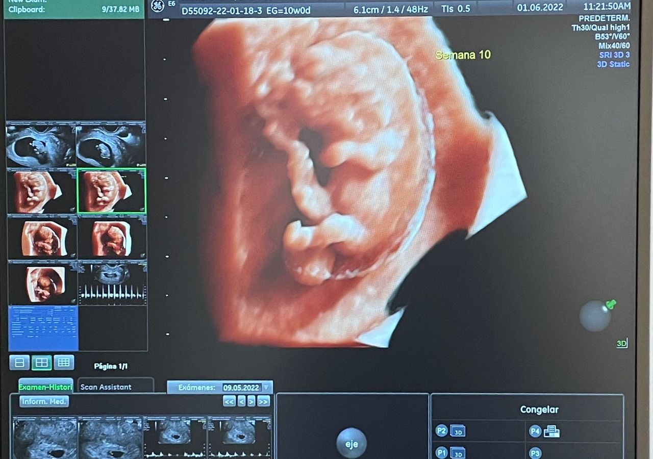 Mayi Mayret Mesquiti-14