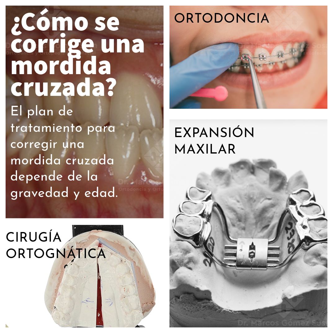 Marcos Gómez Sosa-76