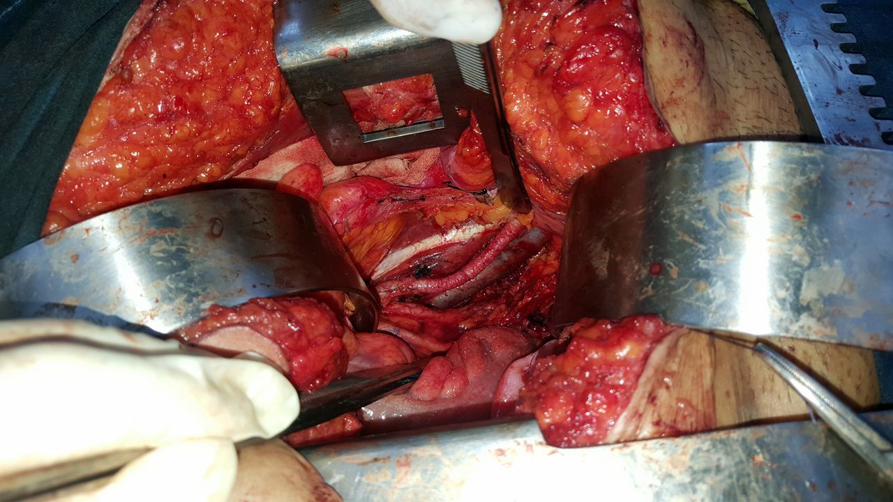 Ángel Millán Juárez-34