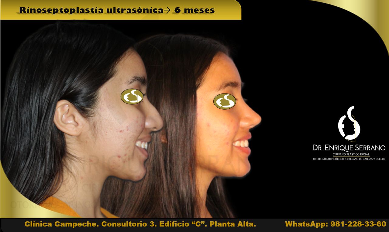 Enrique Serrano Cruz-29