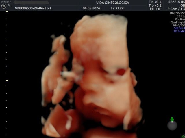 Ana Paula Cardona Grillo-5