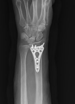 Manuel De Jesús Ambrosio Vicente-5