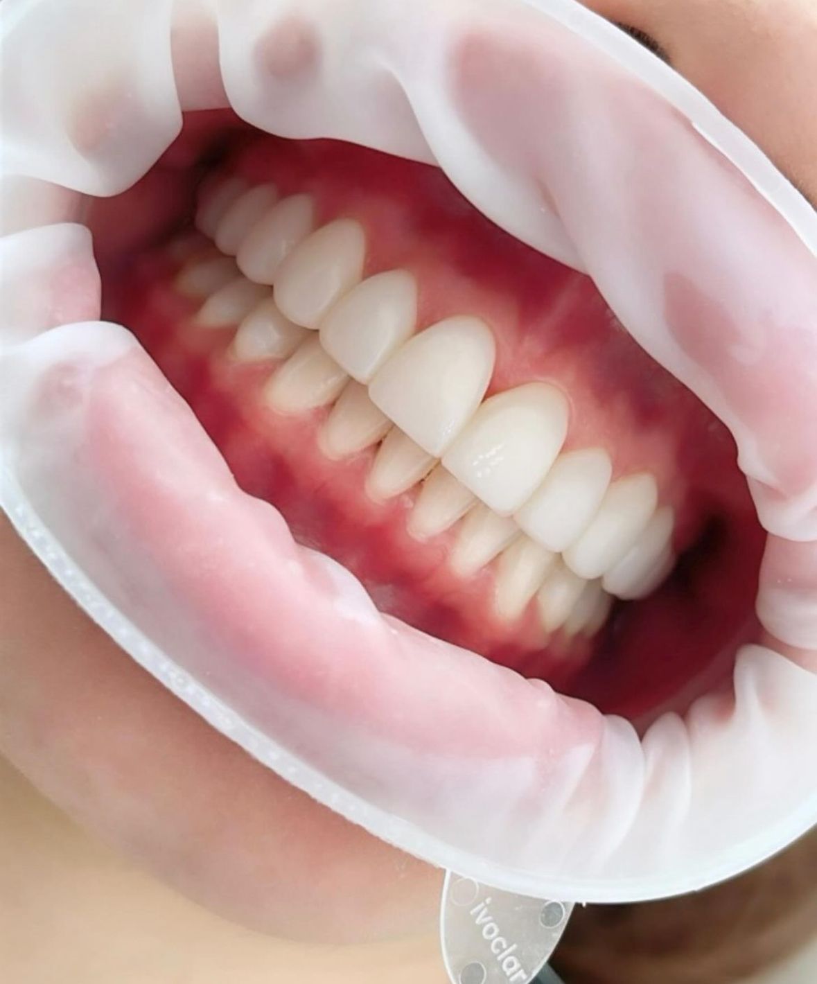 Ricardo Rosado Zamora-22