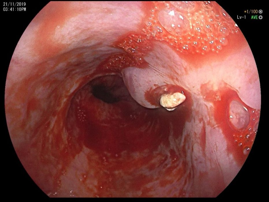 Alejandro Arreola Cruz-9