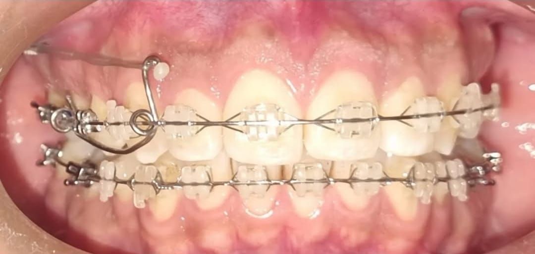 Tulia Andrade Rodriguez-9