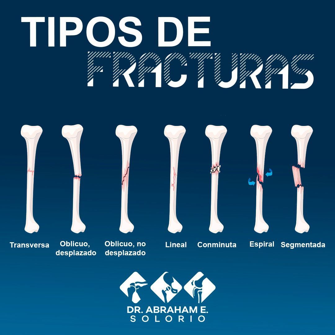 Abraham E. Solorio-35