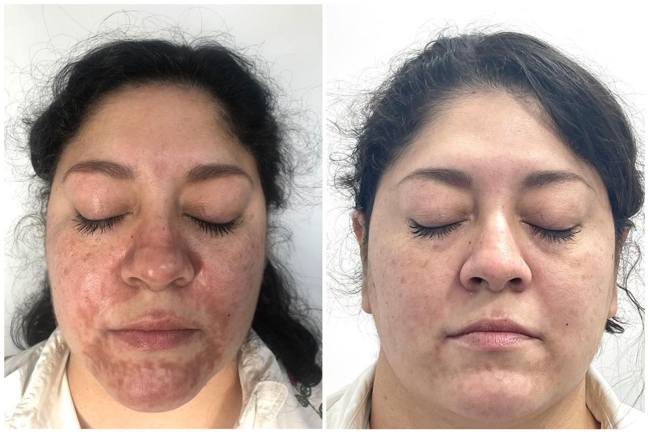 Adrián Martínez Moreno-14