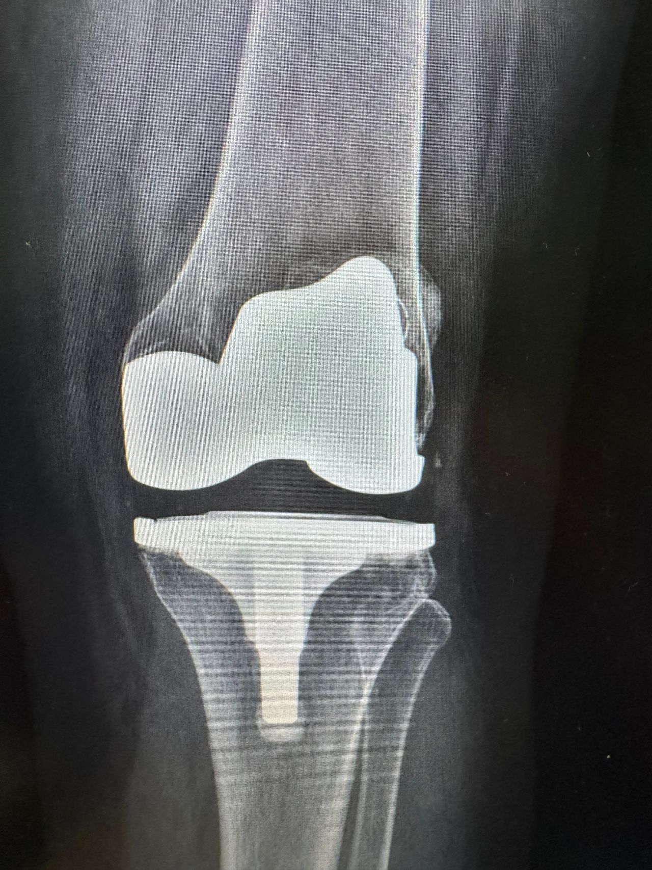 Luis Felipe Graham Nieto-0