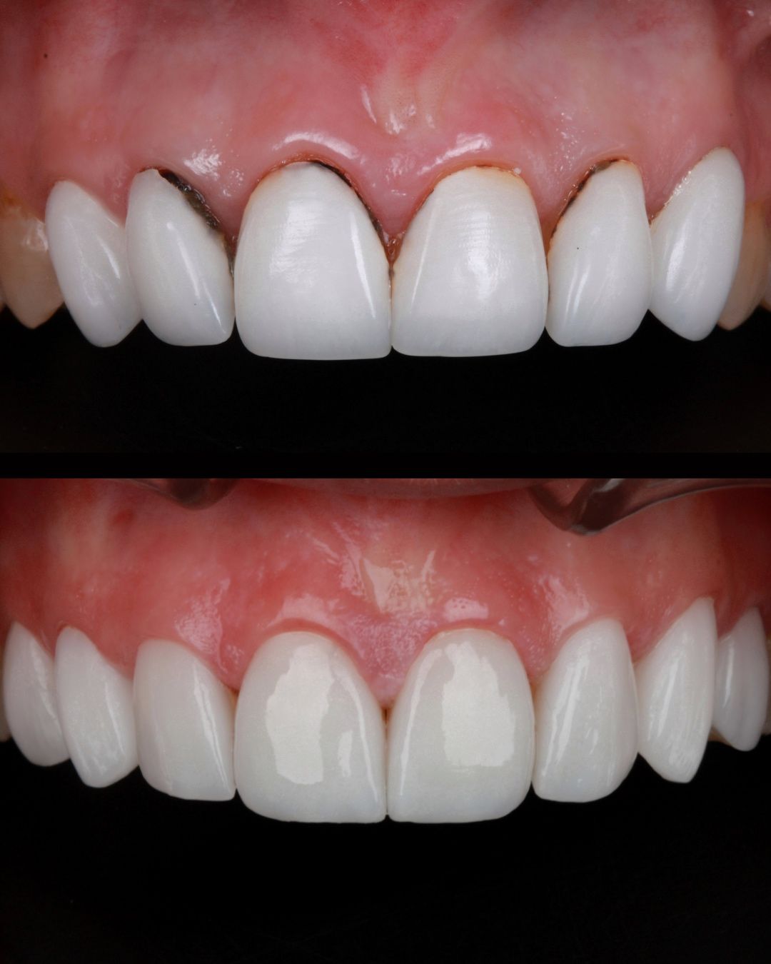 Diana Chacon Cervera-8