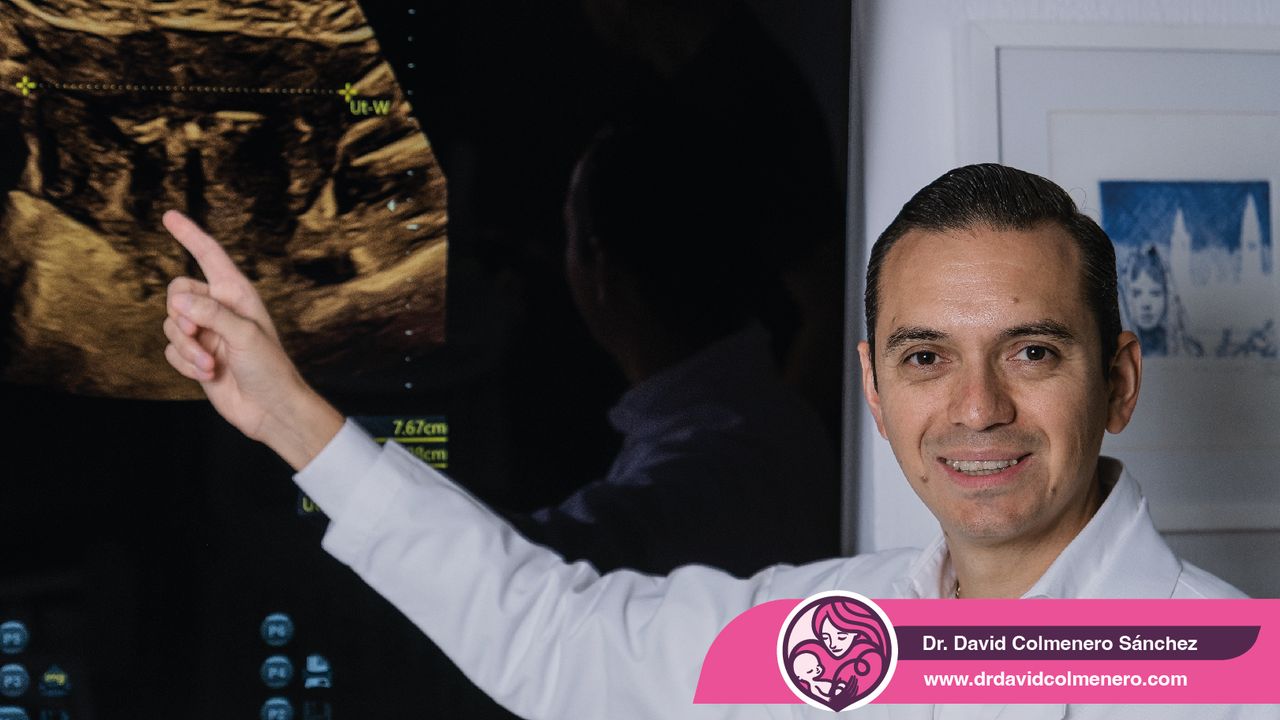 David Colmenero Sánchez-13