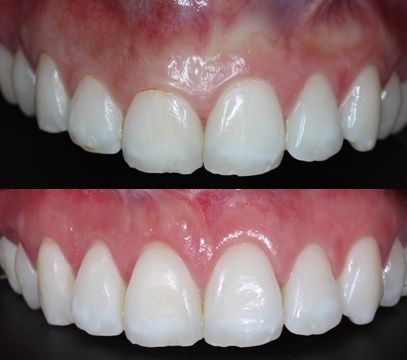 Ireri Rojas Bermúdez-18