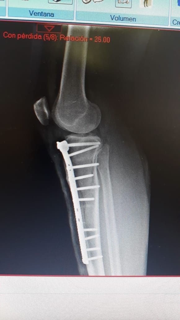 Juan José Luévano De La Cruz-28