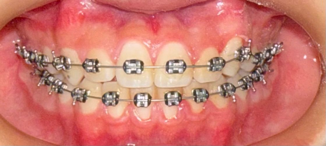 Zoe Guadalupe  Hernandez Aguilar-0