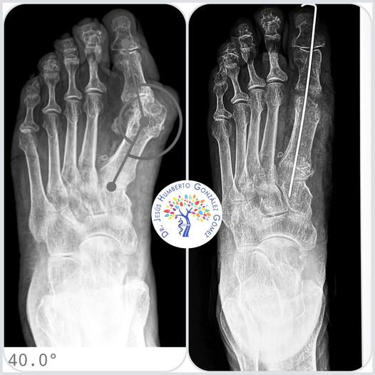 Jesús Humberto González Gómez-29