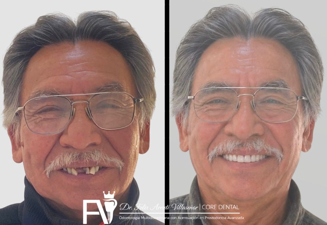 Félix Arruti Villaseñor-23