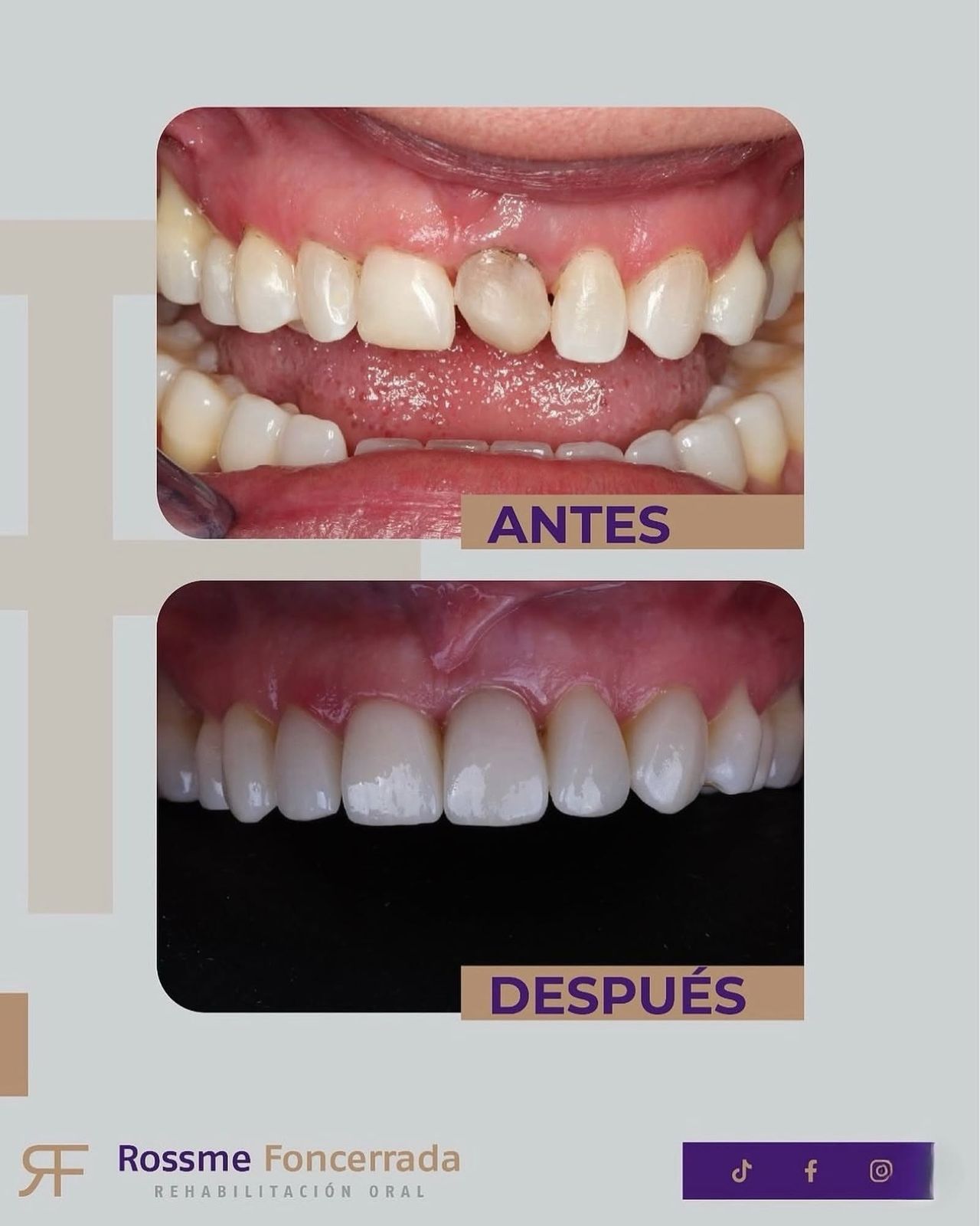 Rossme Foncerrada-19