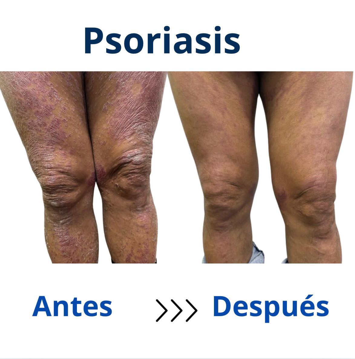 Itzel Anayn Flores Reyes-42