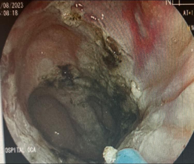 J. César Reyes Vásquez-26