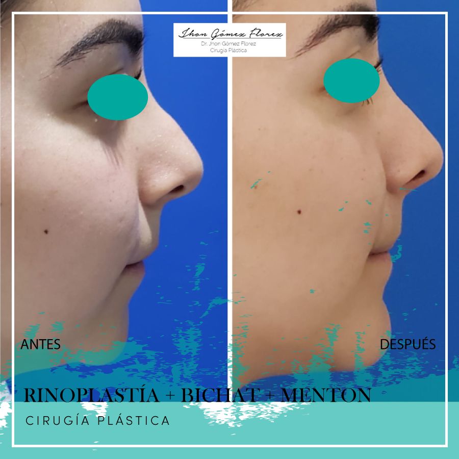 Jhon César Gómez Florez-66