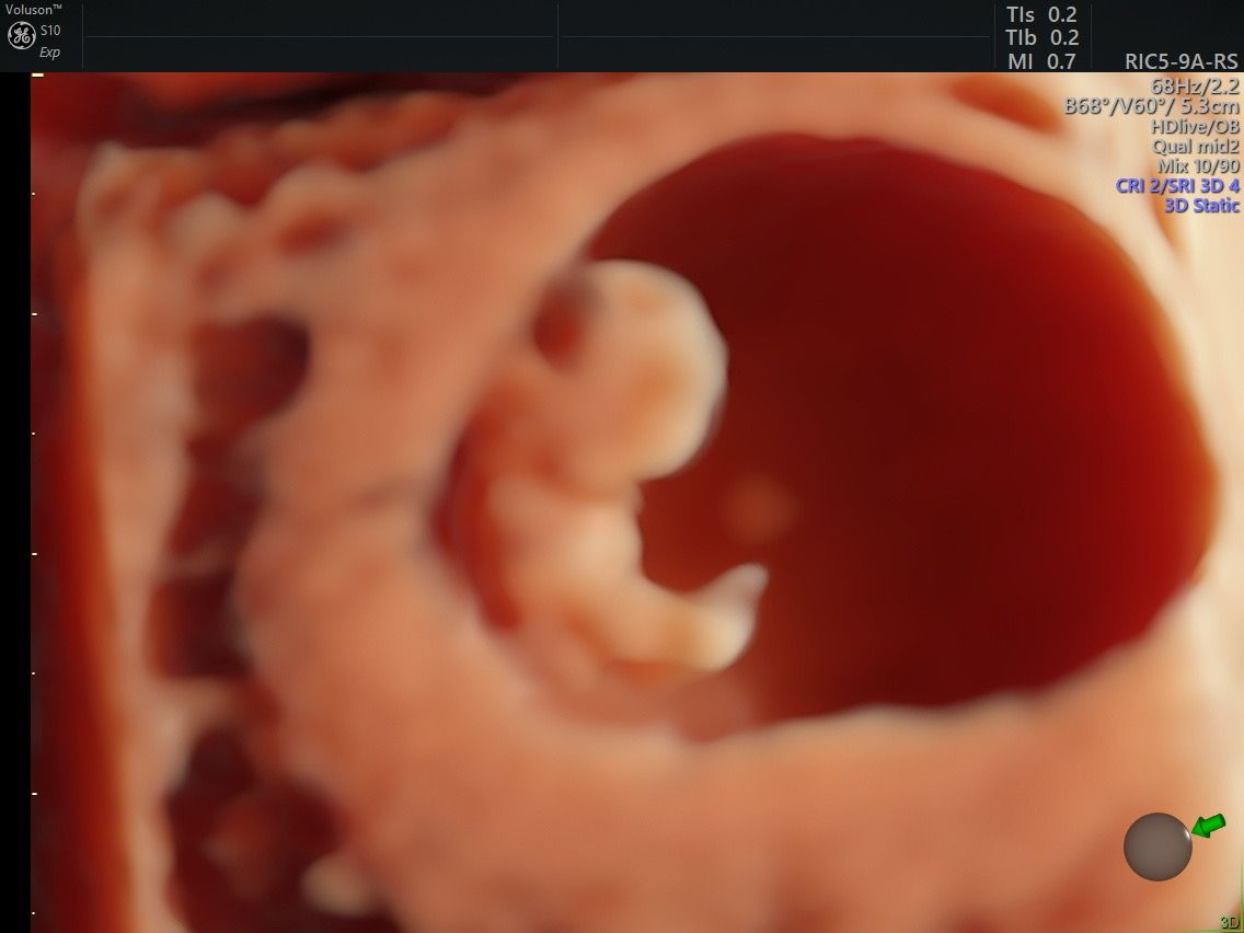 Martín Francisco Pérez Peña-0