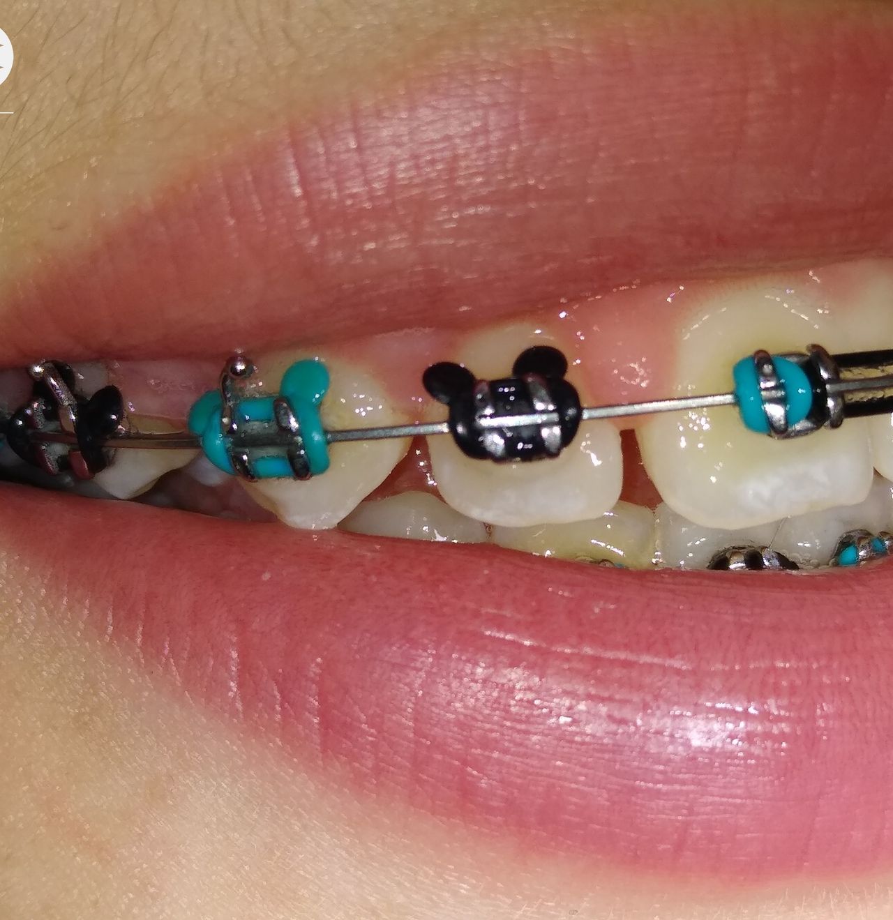 Ami A. Arias Morales-1