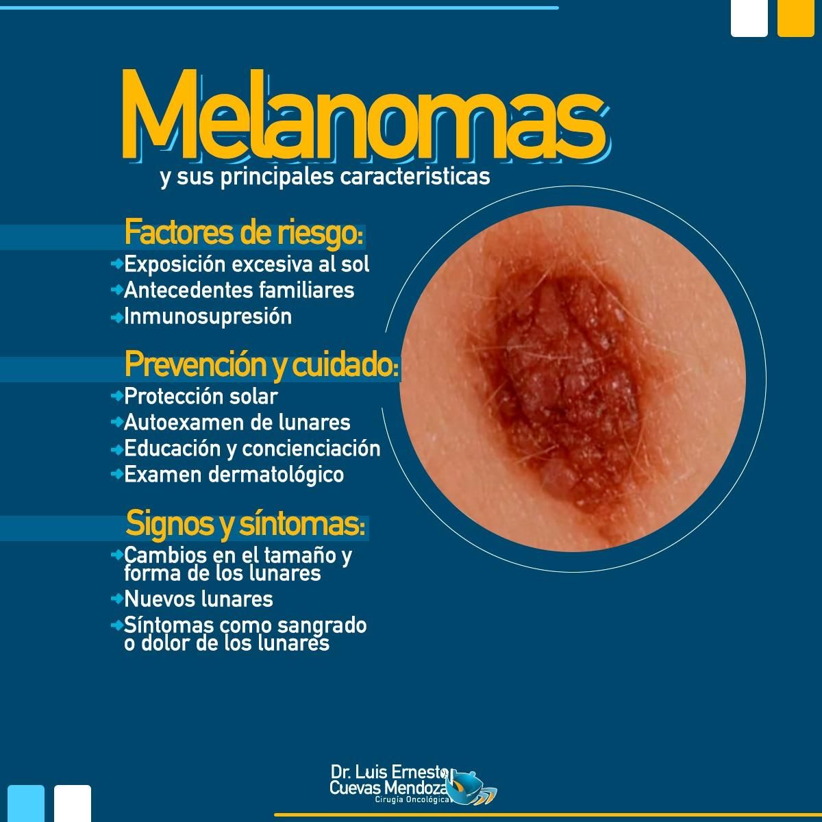 Luis Ernesto Cuevas Mendoza-321