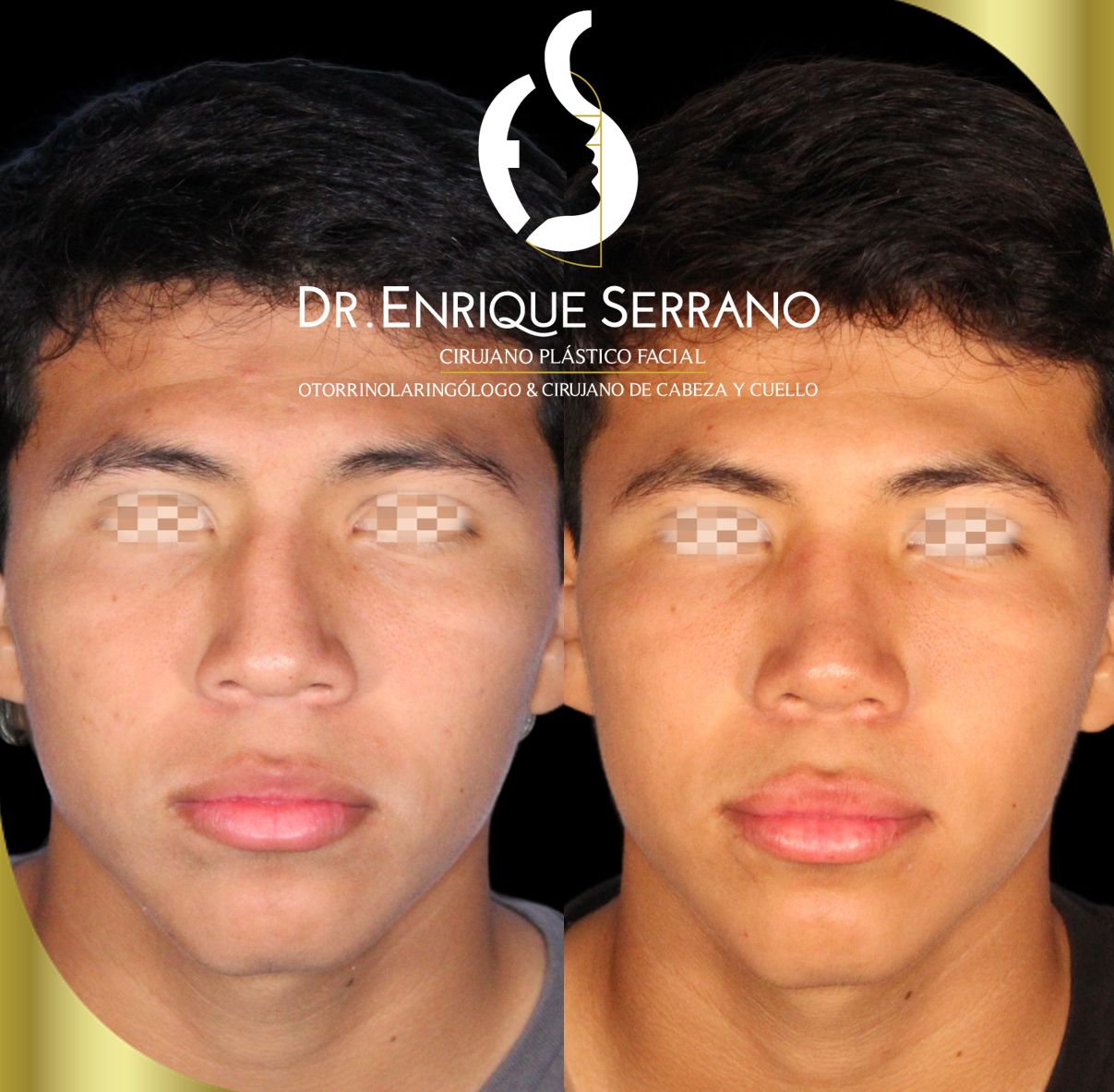 Enrique Serrano Cruz-12