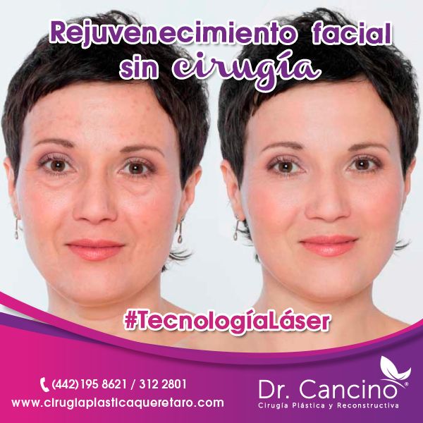 Luis M. R. Cancino-46