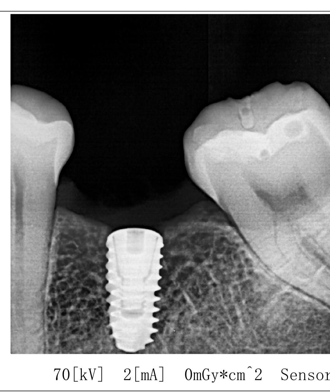 Luis Enrique Cruz Hernández-25