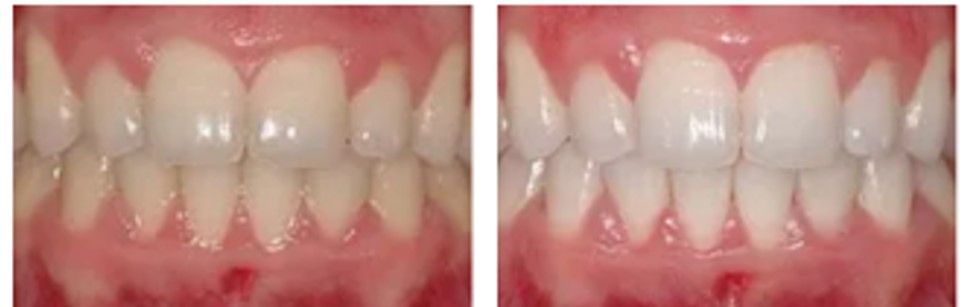 Valeria Xancopinca-9