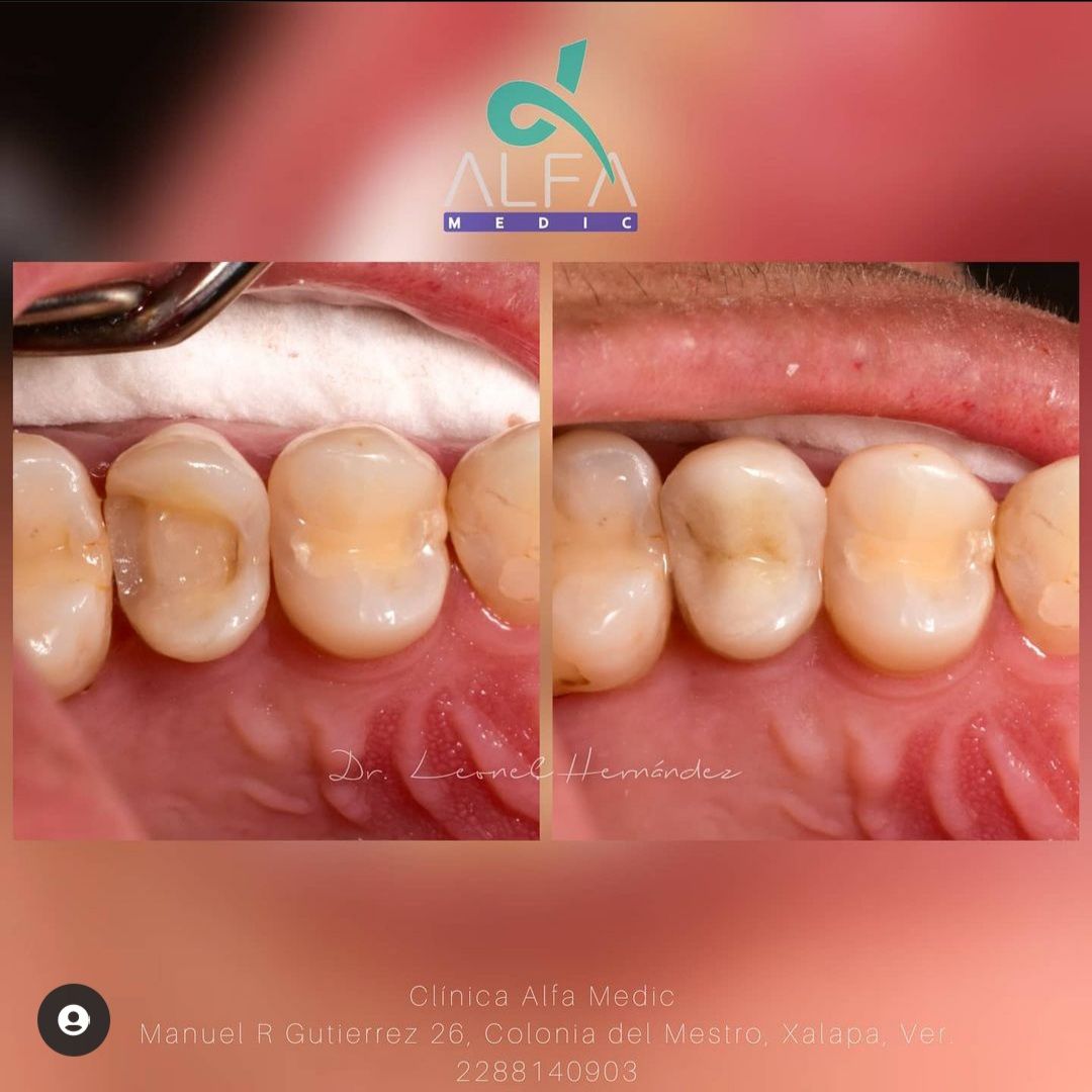 Leonel Hernández Gómez-26