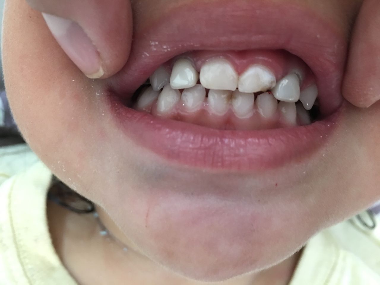 Patricia Rizo Palos-16